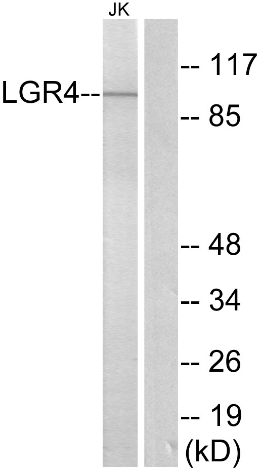 Upload/Product/20178220160822.jpg